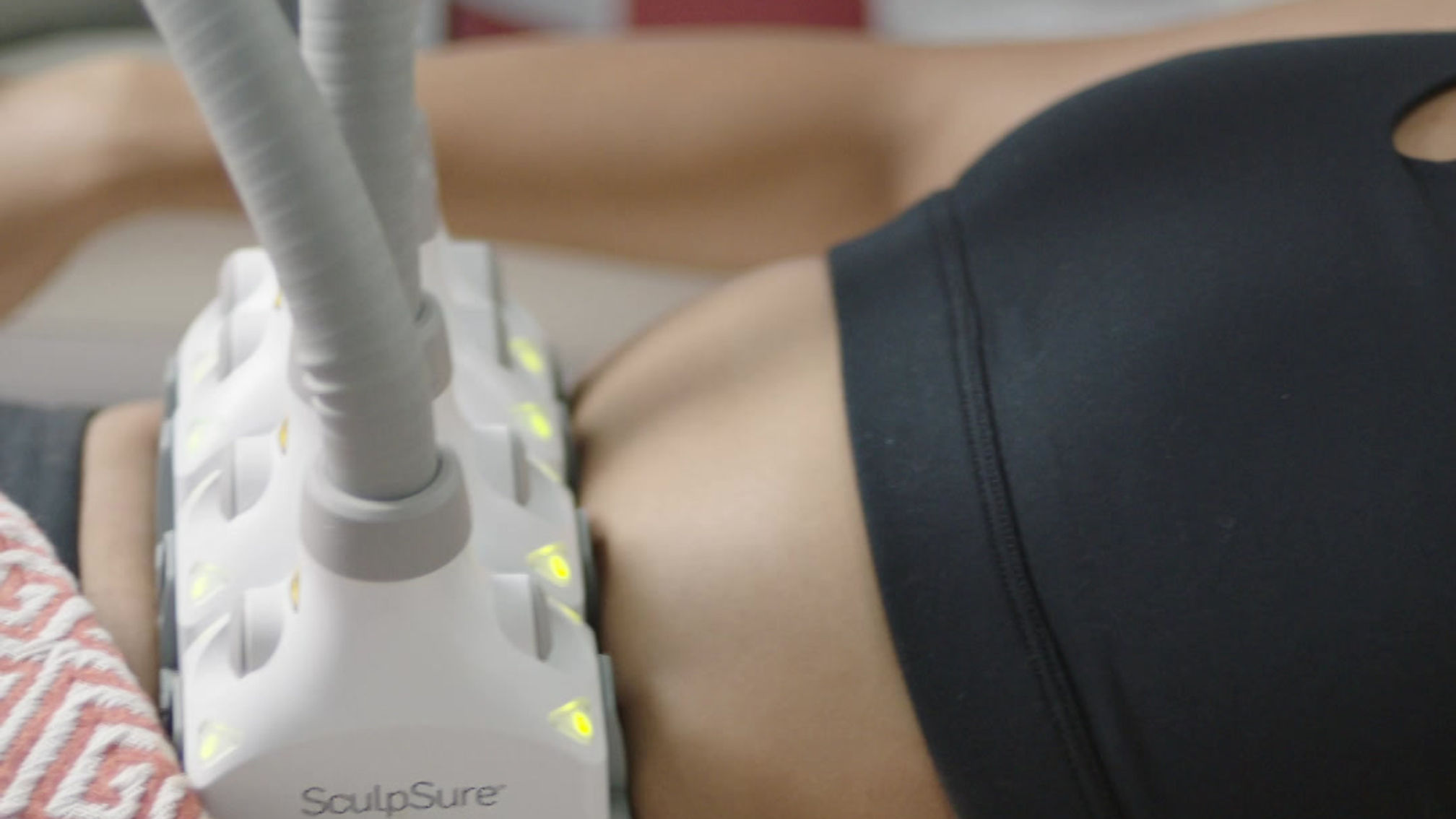 SculpSure_What-a-SculpSure-Treatment-Is